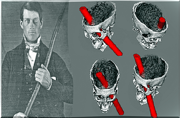 Phineas Gage with his skewer