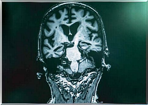 An X-ray image of a brain